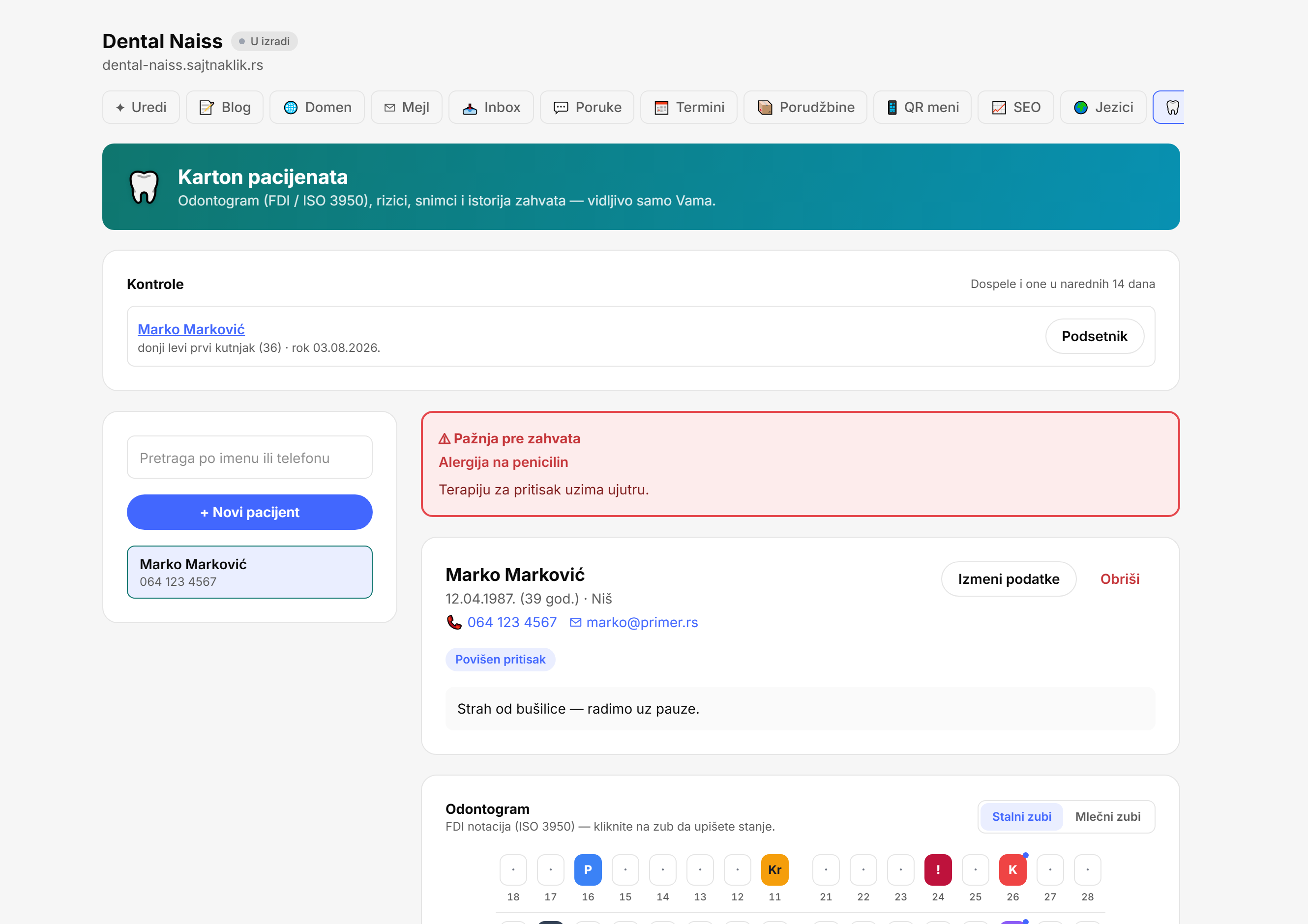 Karton pacijenta sa odontogramom i podsetnikom na kontrolu.